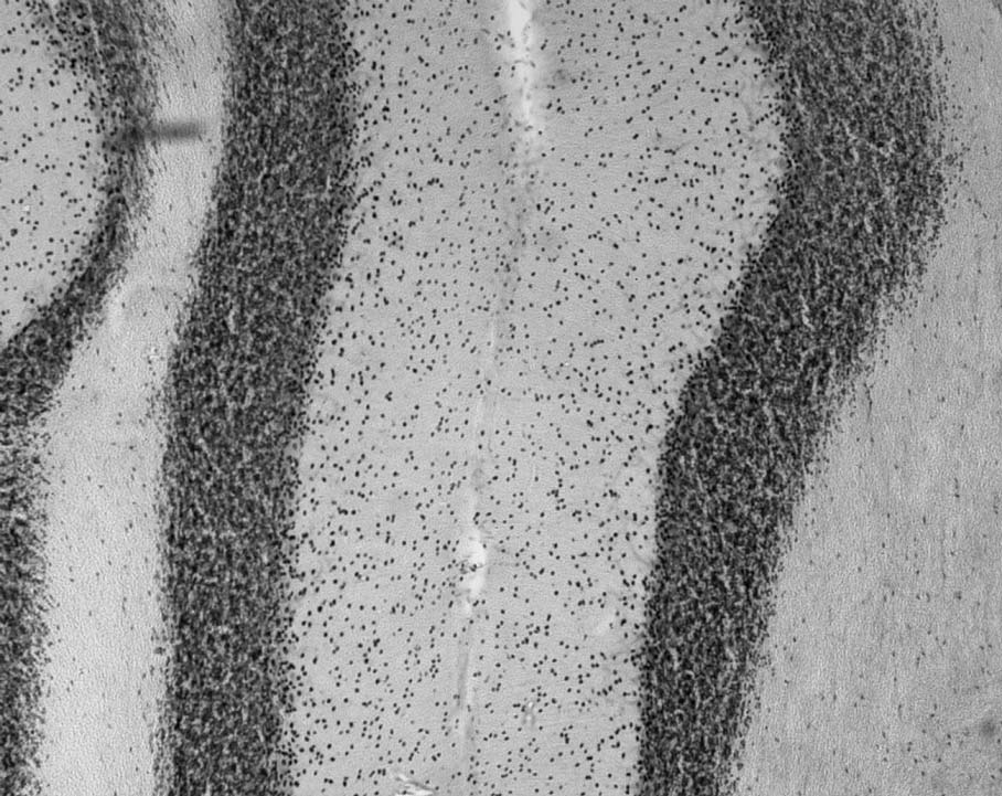 Anti-Ataxin-1, 11NQ Antibody - Image 3