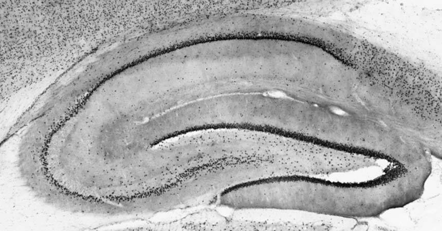 Anti-Ataxin-1, 11NQ Antibody - Image 4