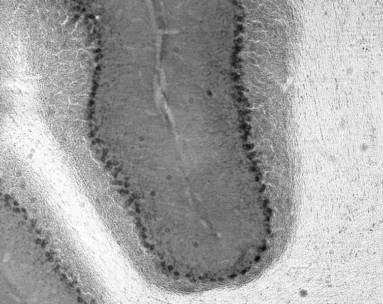 Anti-Ataxin-1, WT Antibody - Image 3