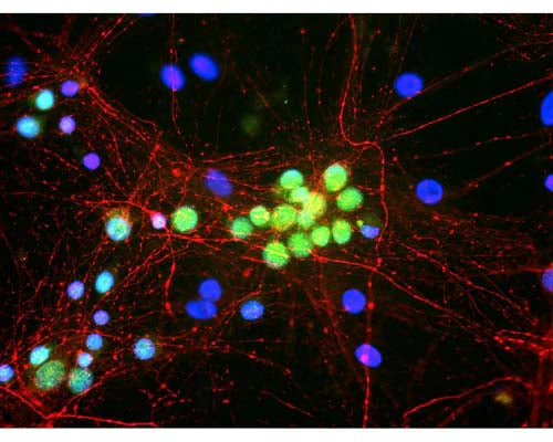 Anti-Ataxin-2 binding protein 1 (A2BP1/Fox1) Antibody - Image 2