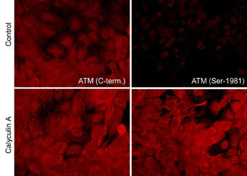 Anti-ATM (Ser-1981), Phosphospecific Antibody - Image 2