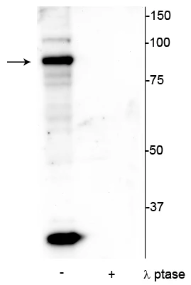 Anti-ATRIP (Ser239) Antibody