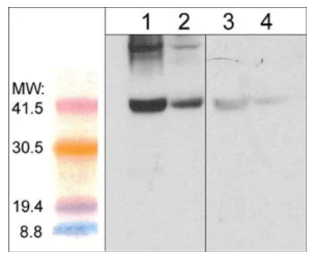 Anti-Atrogin-1 Antibody