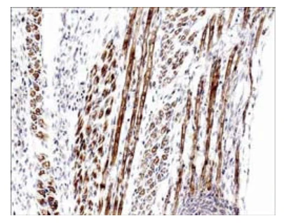 Anti-Atrogin-1 Antibody - Image 2