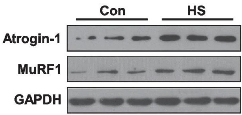 Anti-Atrogin-1 Antibody - Image 4