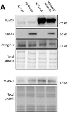 Anti-Atrogin-1 Antibody - Image 7