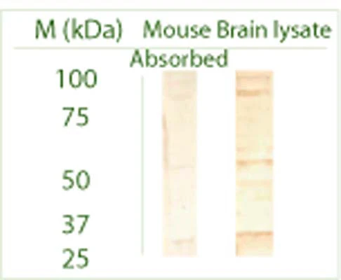 Anti-Autophagy-related protein 3 (ATG3) Antibody - Image 2