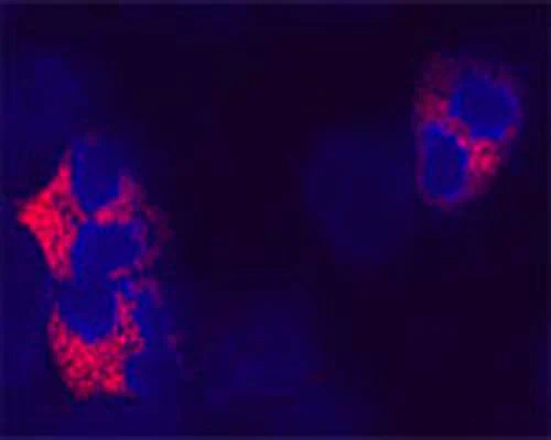 Anti-Autophagy-related protein 7 (ATG7) Antibody