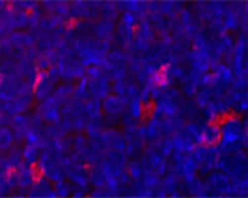 Anti-Autophagy-Related Protein 9A (ATG9A) Antibody