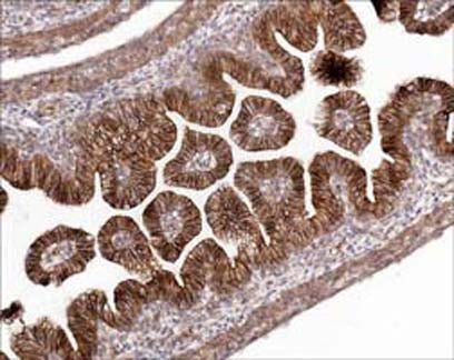 Anti-β-Catenin (N-terminal) Antibody - Image 2