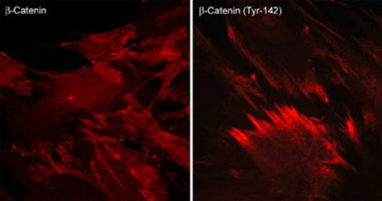 Anti-β-Catenin (Tyr-142) [γ-Catenin (Tyr-133)], Phosphospecific Antibody - Image 2