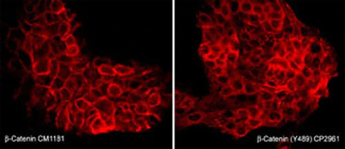 Anti-β-Catenin (Tyr-489) [γ-Catenin (Tyr-480)], Phosphospecific Antibody - Image 2