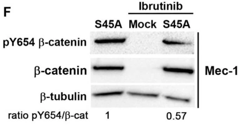 Anti-β-Catenin (Tyr-654) [γ-Catenin (Tyr-644)], Phosphospecific Antibody - Image 3