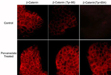 Anti-β-Catenin (Tyr-86), Phosphospecific Antibody - Image 2