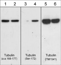Anti-β-Tubulin Antibody