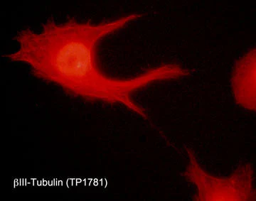 Anti-β-Tubulin (central region) Antibody - Image 2