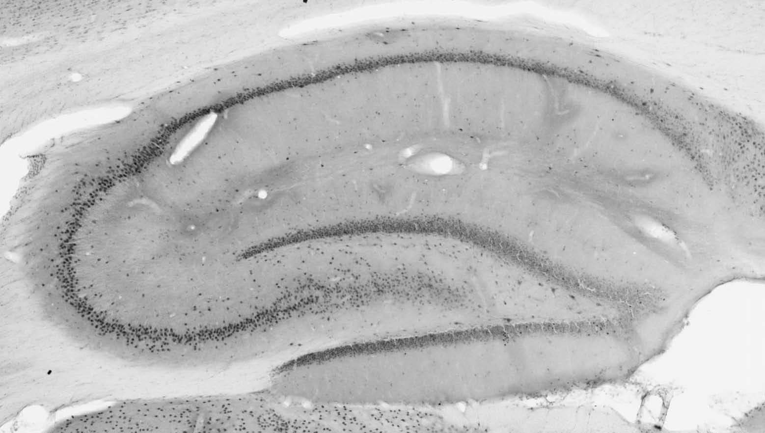 Anti-BAF53b Antibody