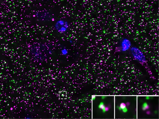 Anti-Bassoon Antibody