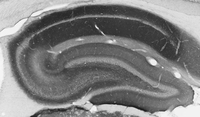 Anti-Bassoon Antibody - Image 2