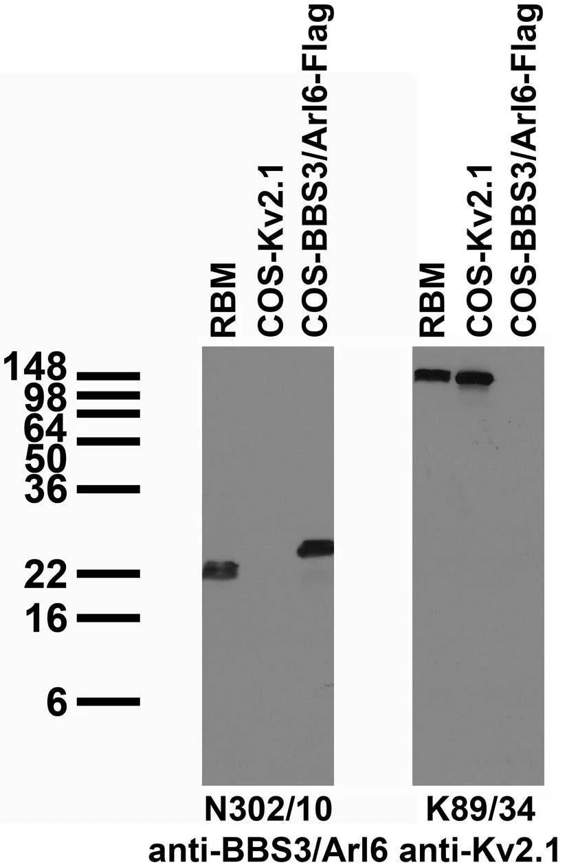 Anti-BBS3/Arl6 Antibody - Image 2