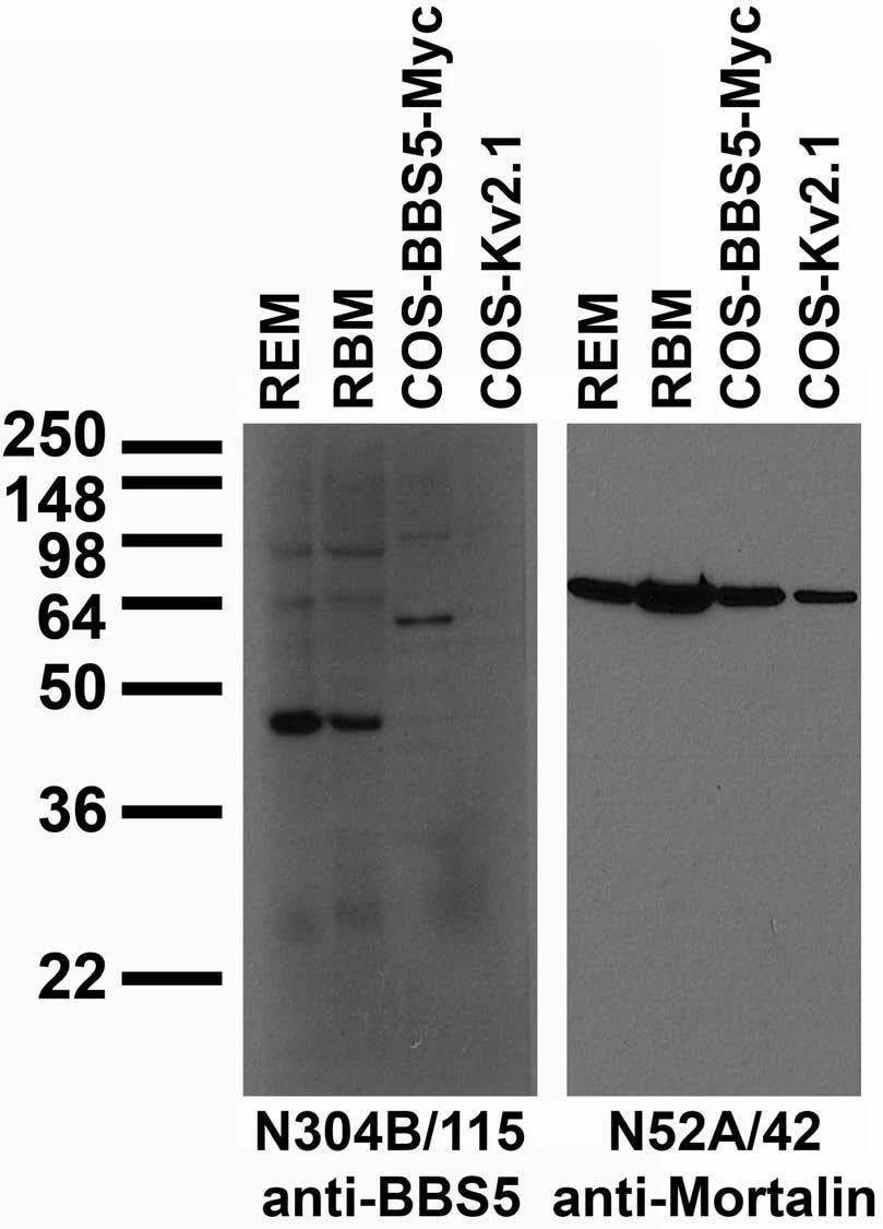 Anti-BBS5 Antibody