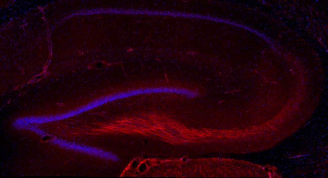 Anti-BDNF Antibody