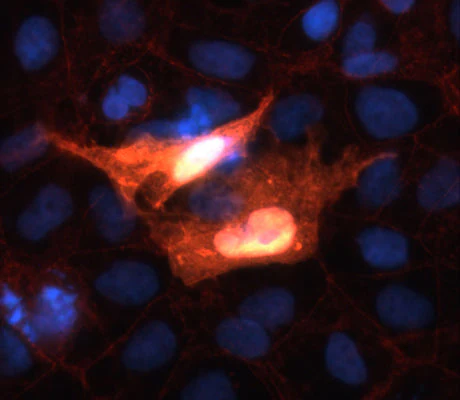 Anti-beta Catenin Antibody
