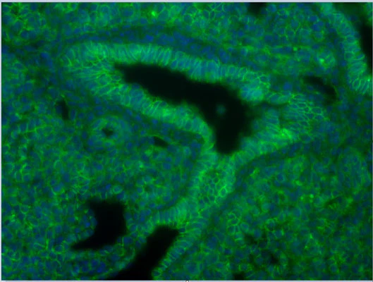 Anti-Beta-Catenin antibody - Image 2