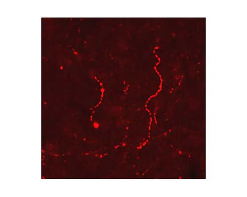 Anti-Beta Lipotropin (Beta-LPH) Antibody