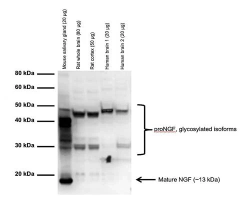 Anti-Beta-nerve growth factor (Beta-NGF) Antibody