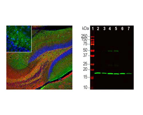 Anti-Beta-Synuclein Antibody