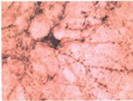 Anti-Beta-synuclein Antibody