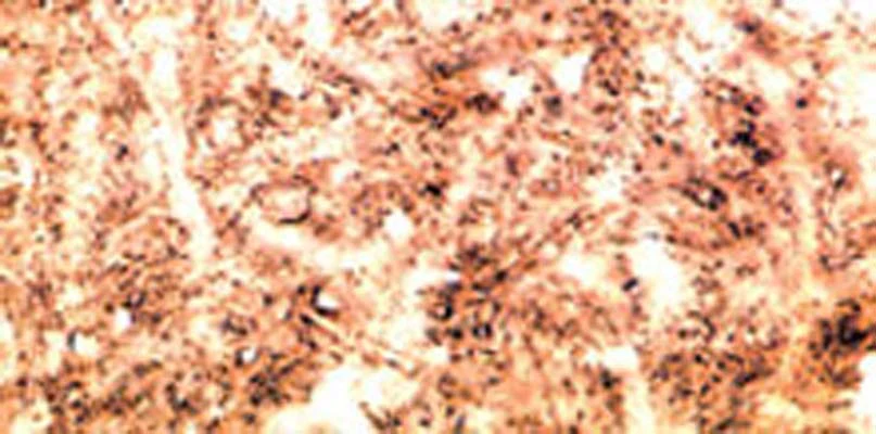Anti-Beta-synuclein Antibody