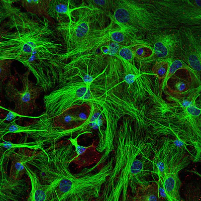 Anti-Beta-Tubulin 3 (TUJ) Antibody - Image 2