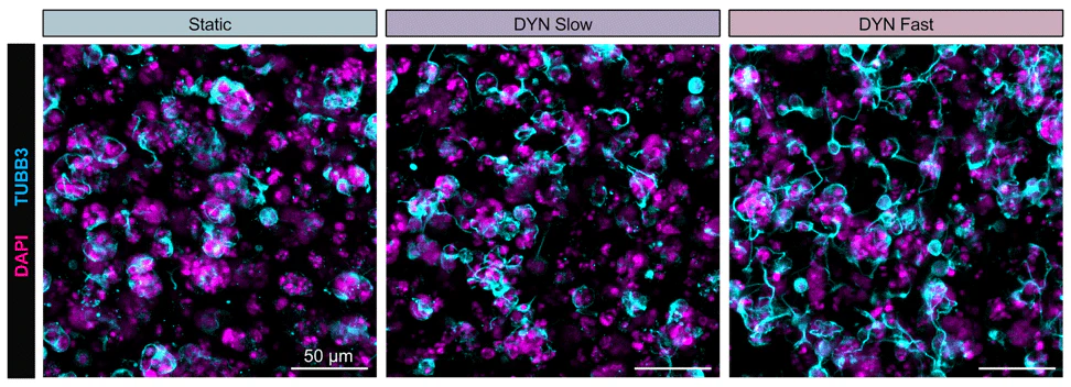 Anti-Beta-Tubulin 3 (TUJ) Antibody - Image 7