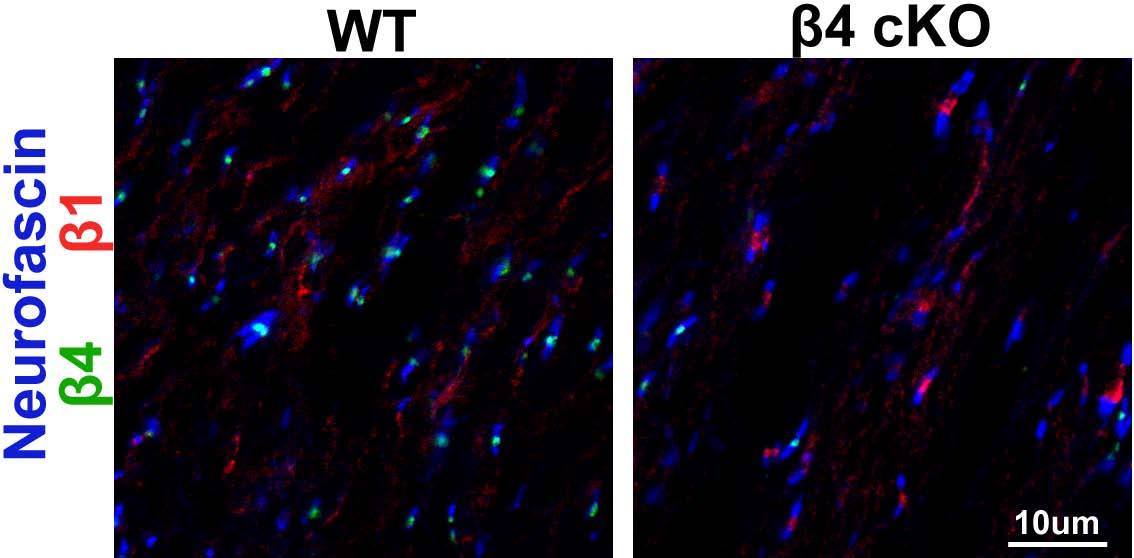 Anti-Beta1-Spectrin Antibody