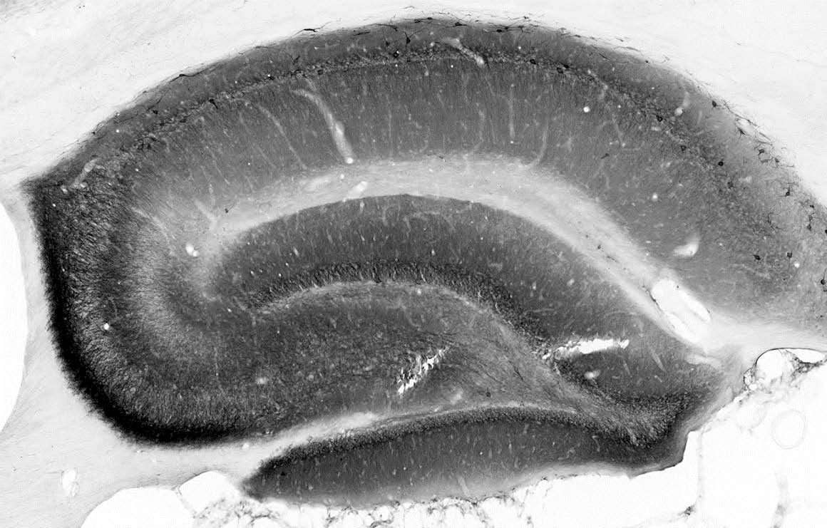 Anti-Beta1-Spectrin Antibody - Image 3