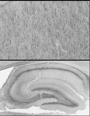 Anti-Beta4-Spectrin Antibody - Image 3
