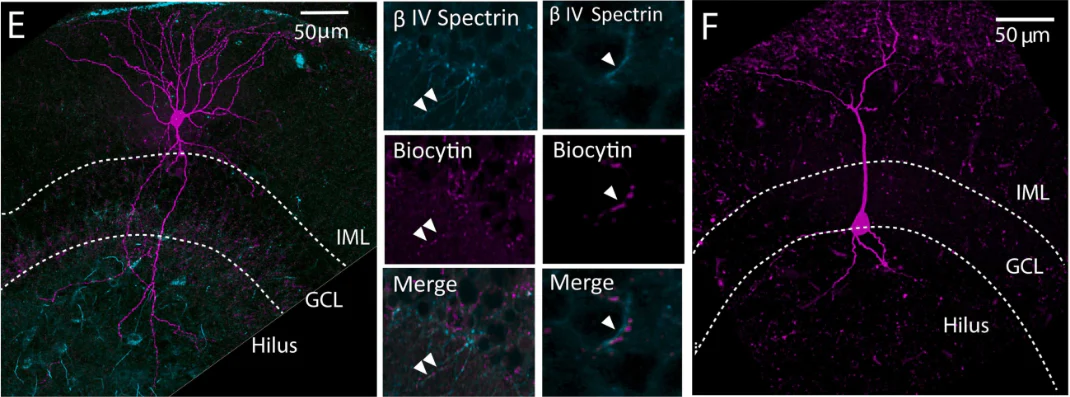 Anti-Beta4-Spectrin Antibody - Image 4