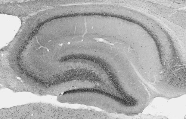 Anti-Beta4-Spectrin Antibody - Image 2