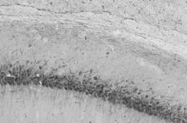 Anti-Beta4-Spectrin Antibody - Image 3