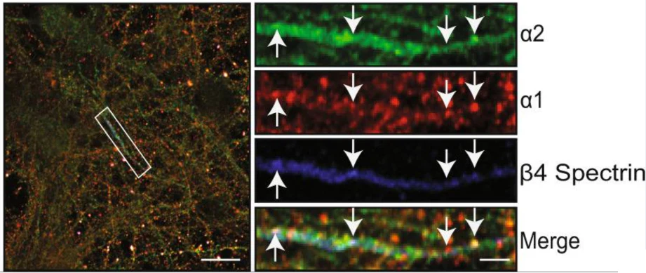 Anti-Beta4-Spectrin Antibody - Image 5