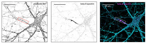 Anti-Beta4-Spectrin Antibody - Image 6