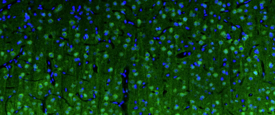 Anti-Beta4-Spectrin Recombinant Chicken Chimeric mAb