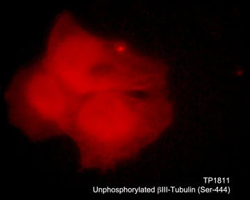 Anti-βIII-Tubulin Antibody - Image 2