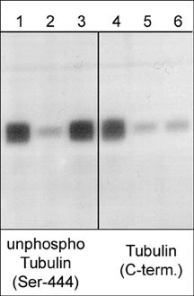 Anti-βIII-Tubulin (C-terminus) Antibody