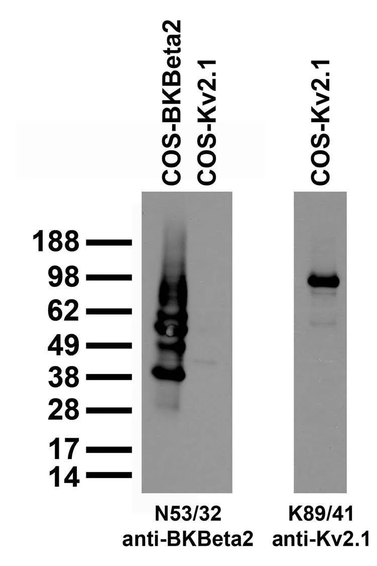 Anti-BKbeta2 K+ Channel Antibody