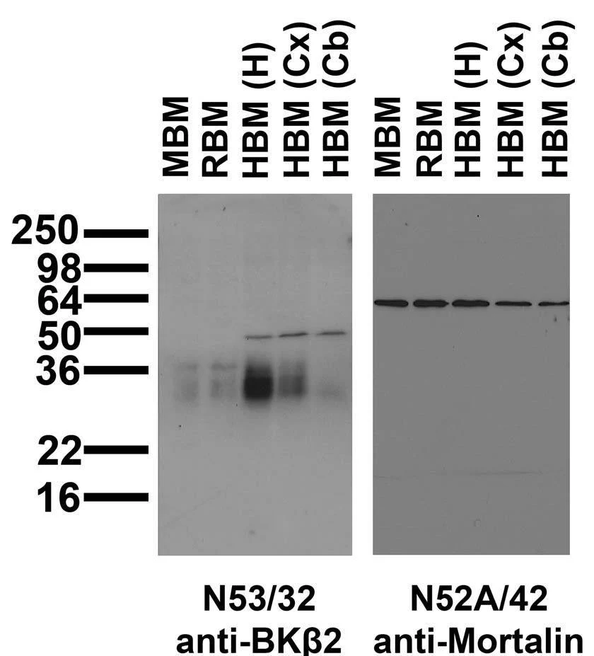 Anti-BKbeta2 K+ Channel Antibody - Image 2