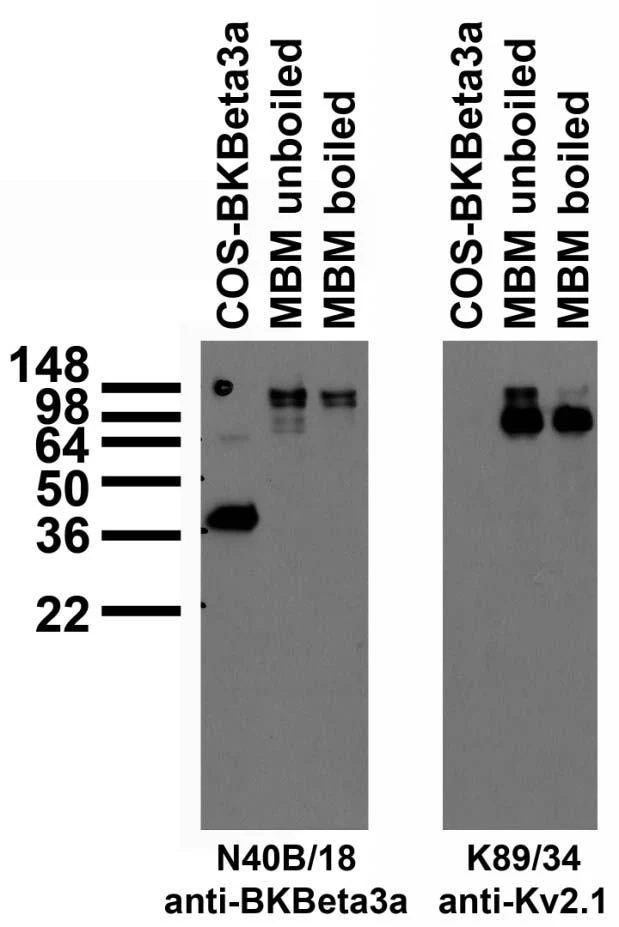 Anti-BKbeta3a K+ Channel Antibody - Image 3
