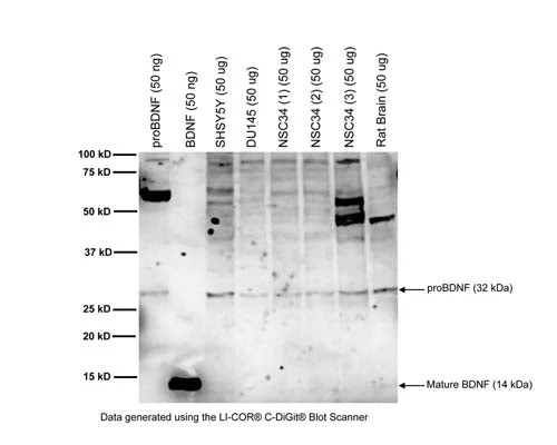 Anti-Brain-derived neurotrophic factor (BDNF) Antibody